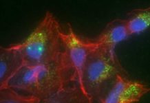 Le nanoplastiche possono interferire con comunicazione cellulare nel mieloma multiplo Le nanoplastiche possono interferire con comunicazione cellulare nel mieloma multiplo