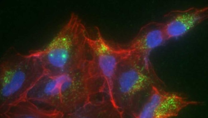 Le nanoplastiche possono interferire con comunicazione cellulare nel mieloma multiplo Le nanoplastiche possono interferire con comunicazione cellulare nel mieloma multiplo
