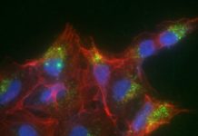 Le nanoplastiche possono interferire con comunicazione cellulare nel mieloma multiplo